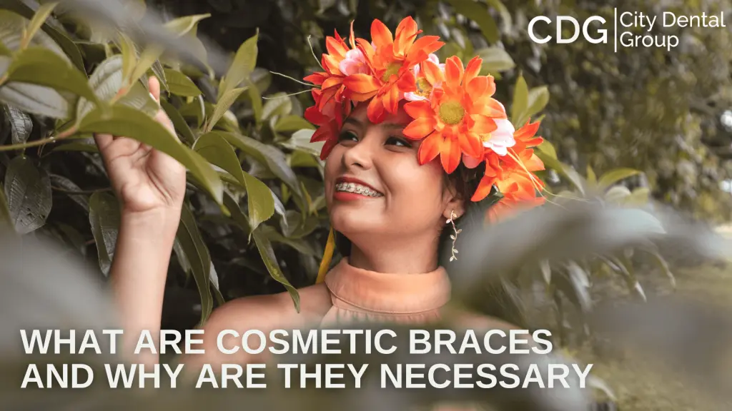 What Are Cosmetic Braces and Why Are They Necessary