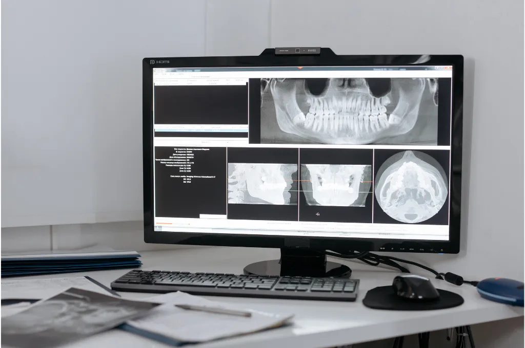 What Are Digital X-Rays