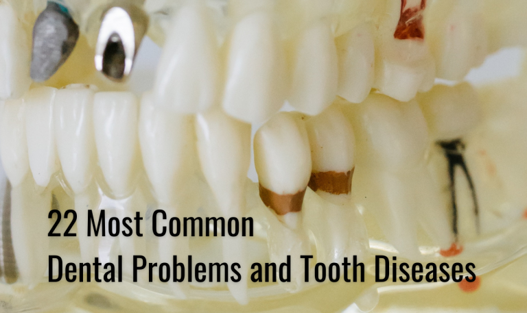 Most Common Dental Problems and Common Tooth Diseases