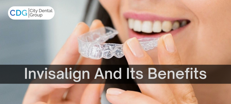 Benefits Of Invisalign