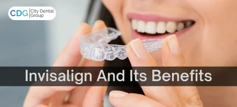 Benefits of Invisalign