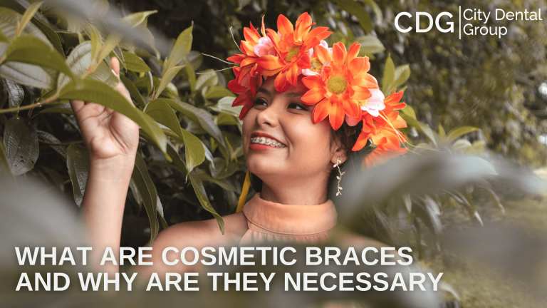 What Are Cosmetic Braces and Why Are They Necessary