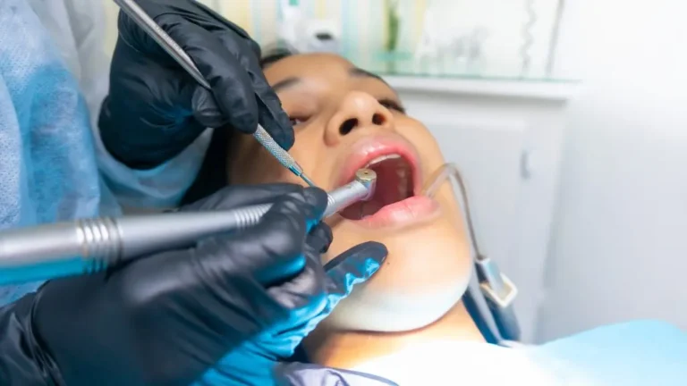 Optimal Timing for Wisdom Tooth Extraction