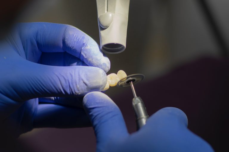 Common Causes for a Wisdom Tooth Extraction by City Dental Group