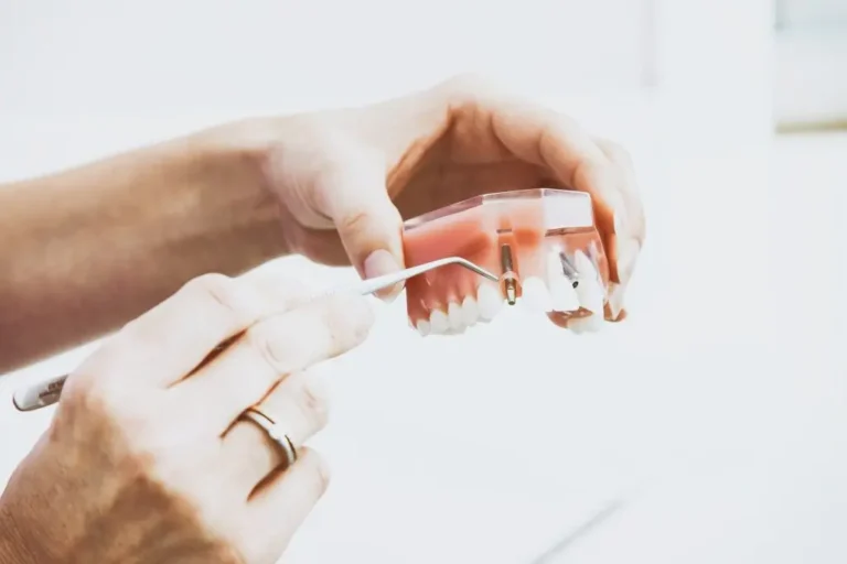 Most Common Types of Dental Filling