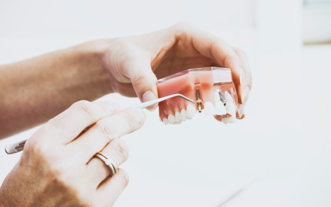 The Most Common Types of Dental Filling